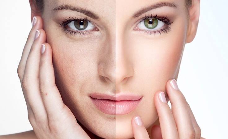 breast-augmentation-service