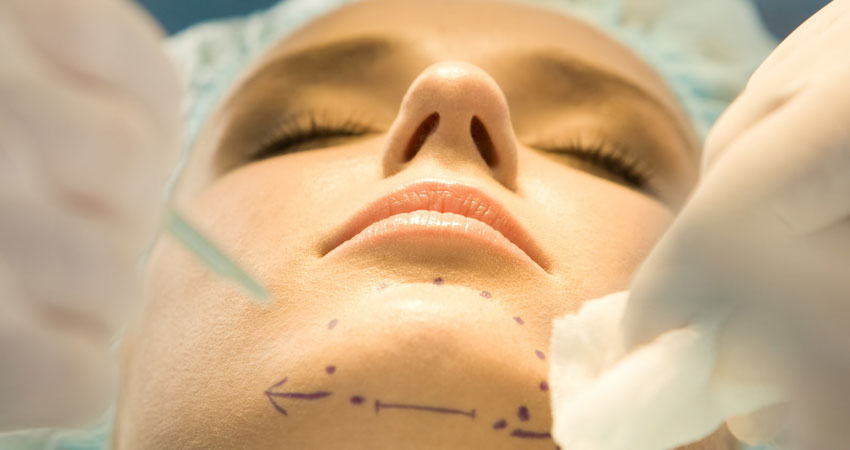 chin-implants-service