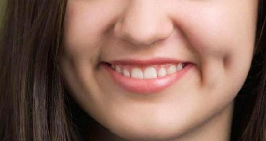 dimple-creation-service