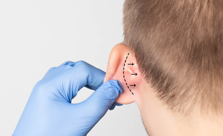 breast-augmentation-service