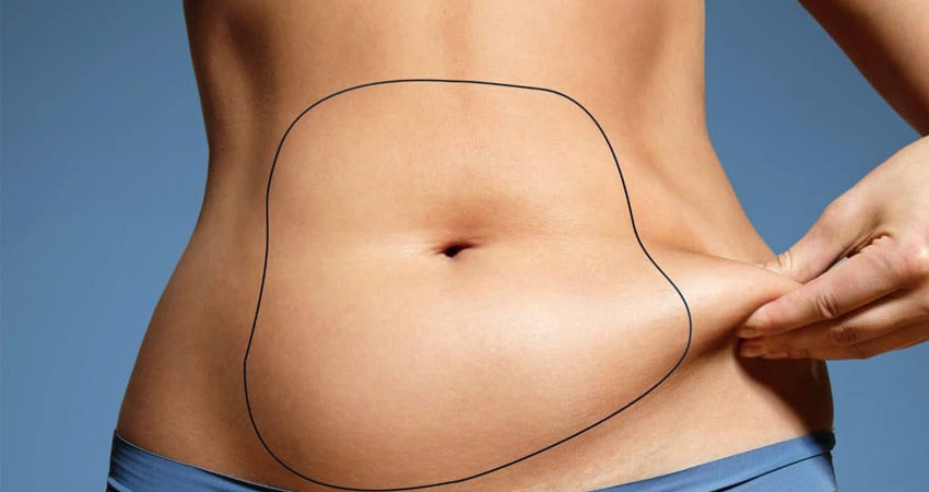 liposuction-service