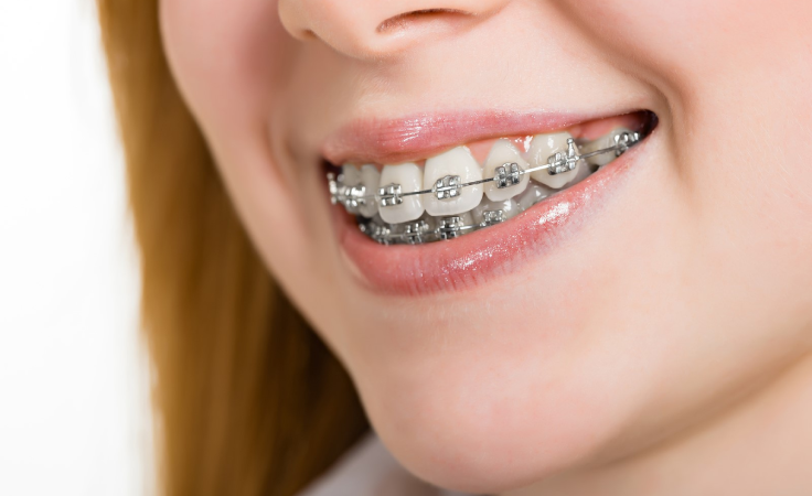 breast-augmentation-service